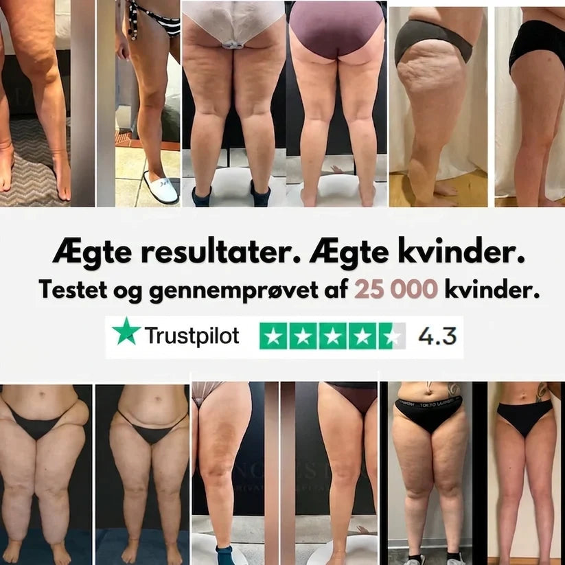 3D anti-cellulit shorts